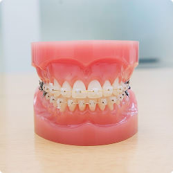 ブラケット装置を装着した画像