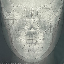 セファログラム画像1