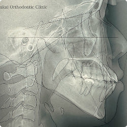 セファログラム画像2