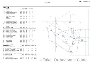 セファログラム分析画像2