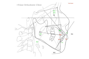 セファログラム分析画像3