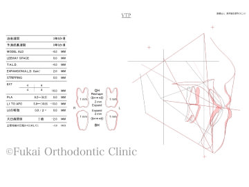 リケッツ分析・スタイナー分析の画像1